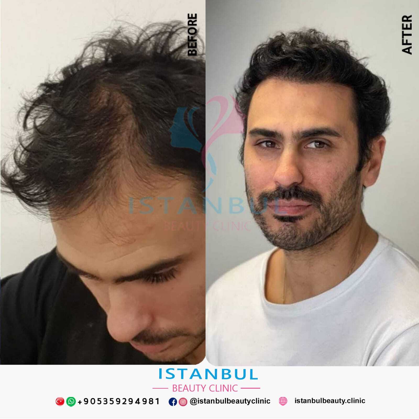 Istanbul Beauty Clinic photo 2