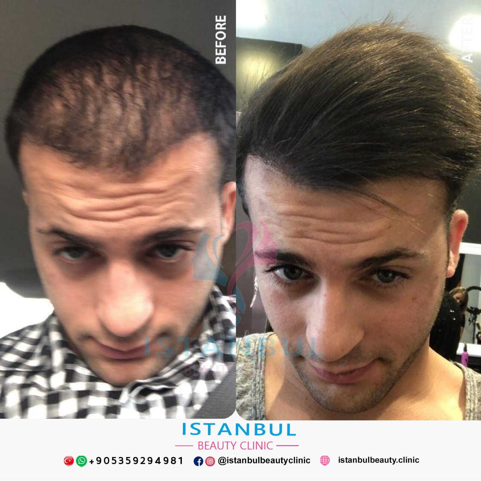 Istanbul Beauty Clinic photo 3