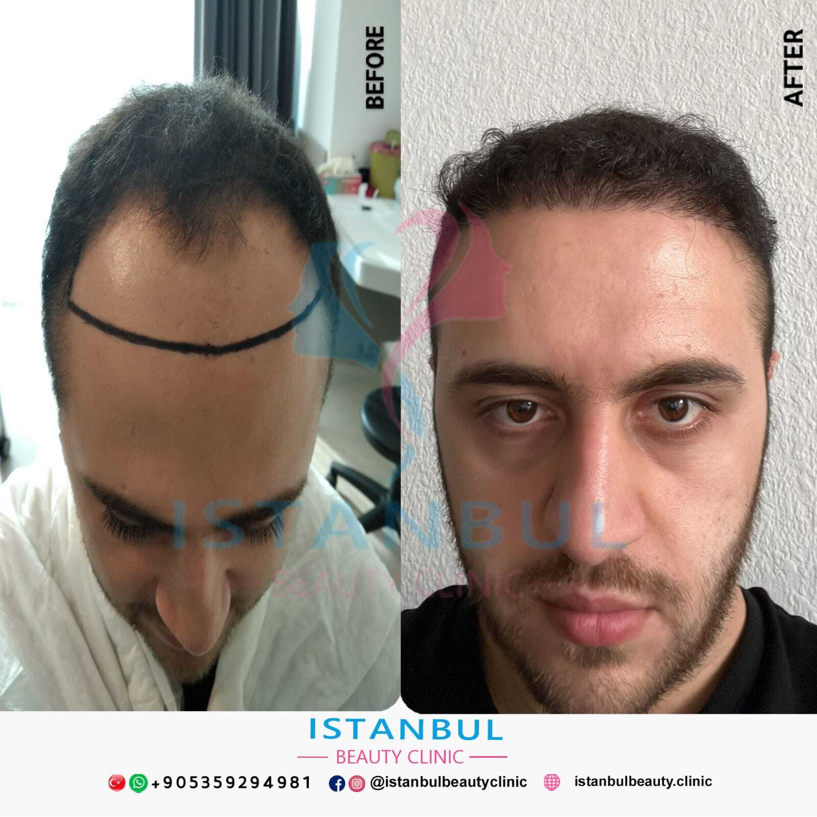 Istanbul Beauty Clinic photo 4