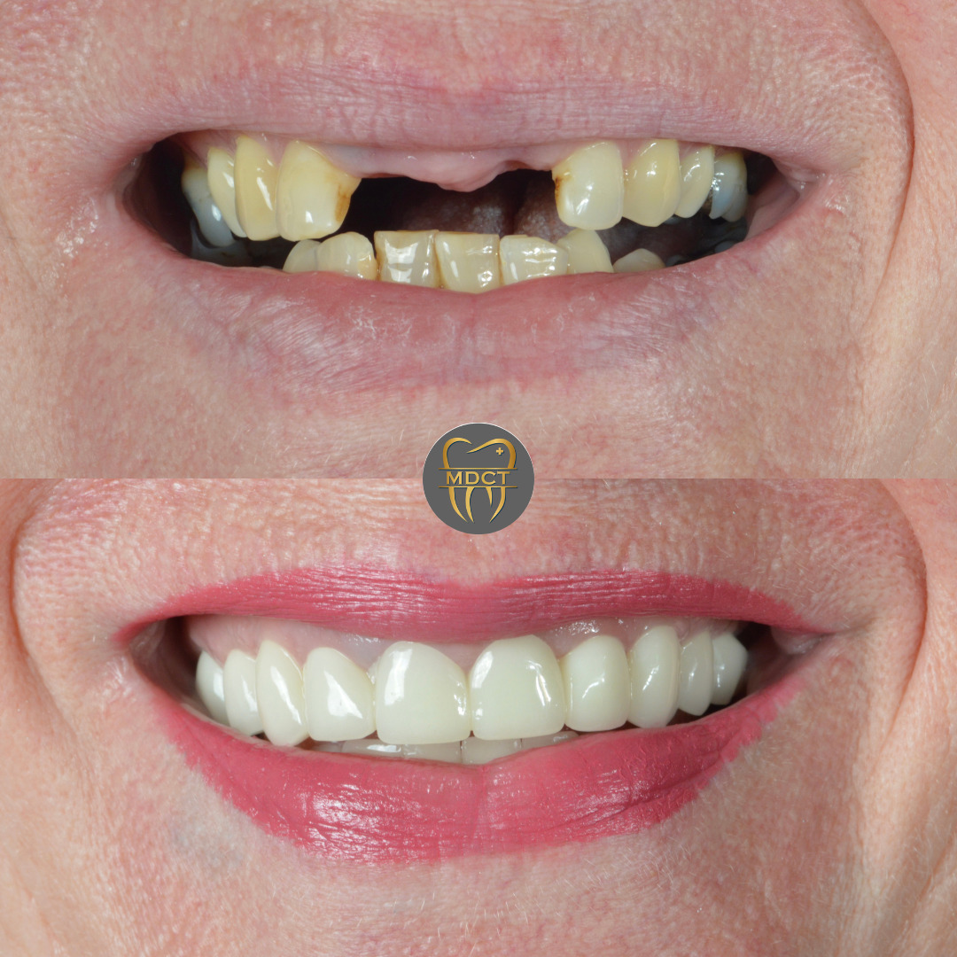 Marmaris Dental Clinic Turkey photo 1