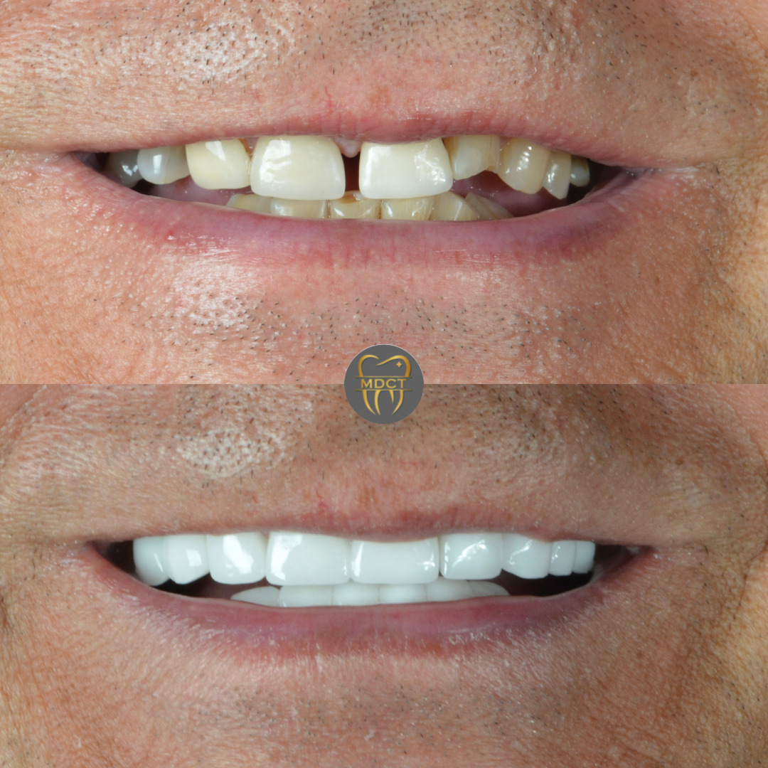 Marmaris Dental Clinic Turkey photo 2
