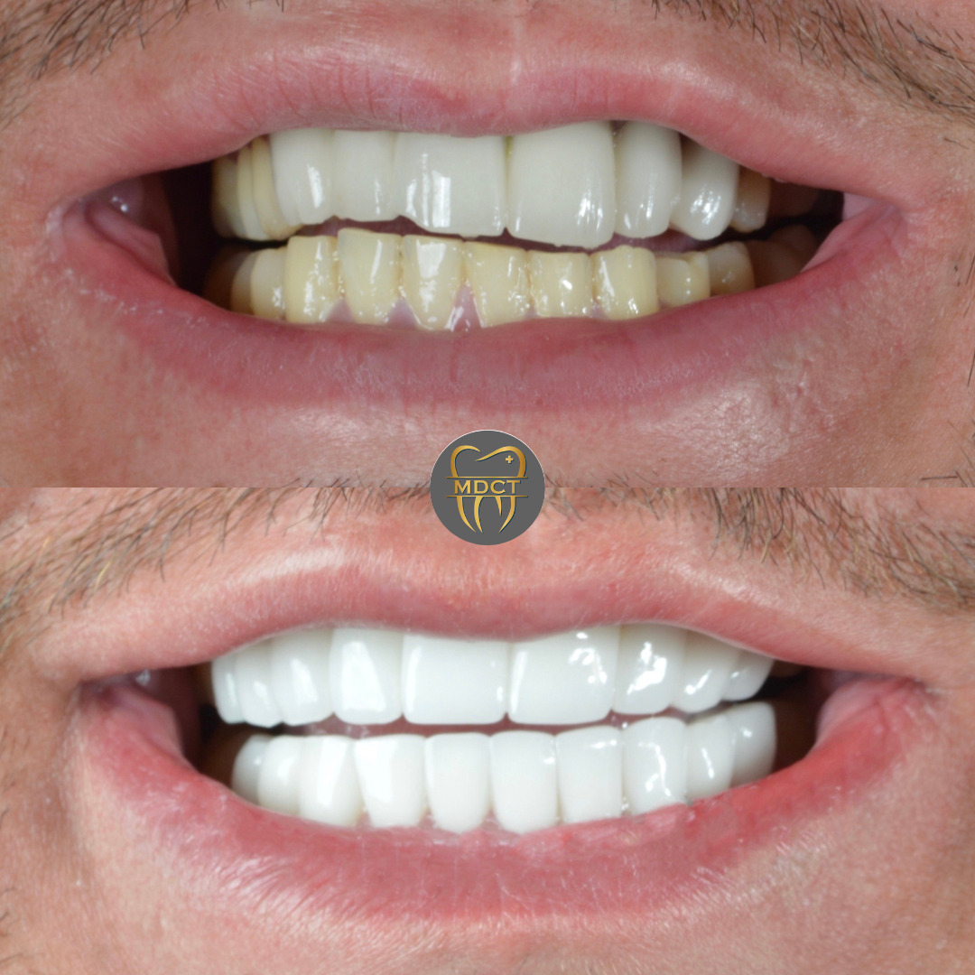 Marmaris Dental Clinic Turkey photo 3