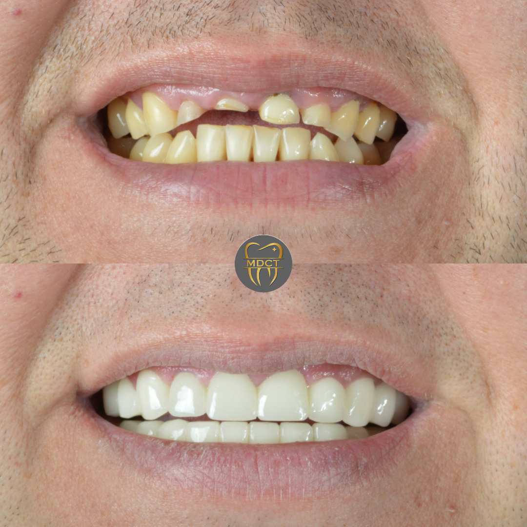Marmaris Dental Clinic Turkey photo 4