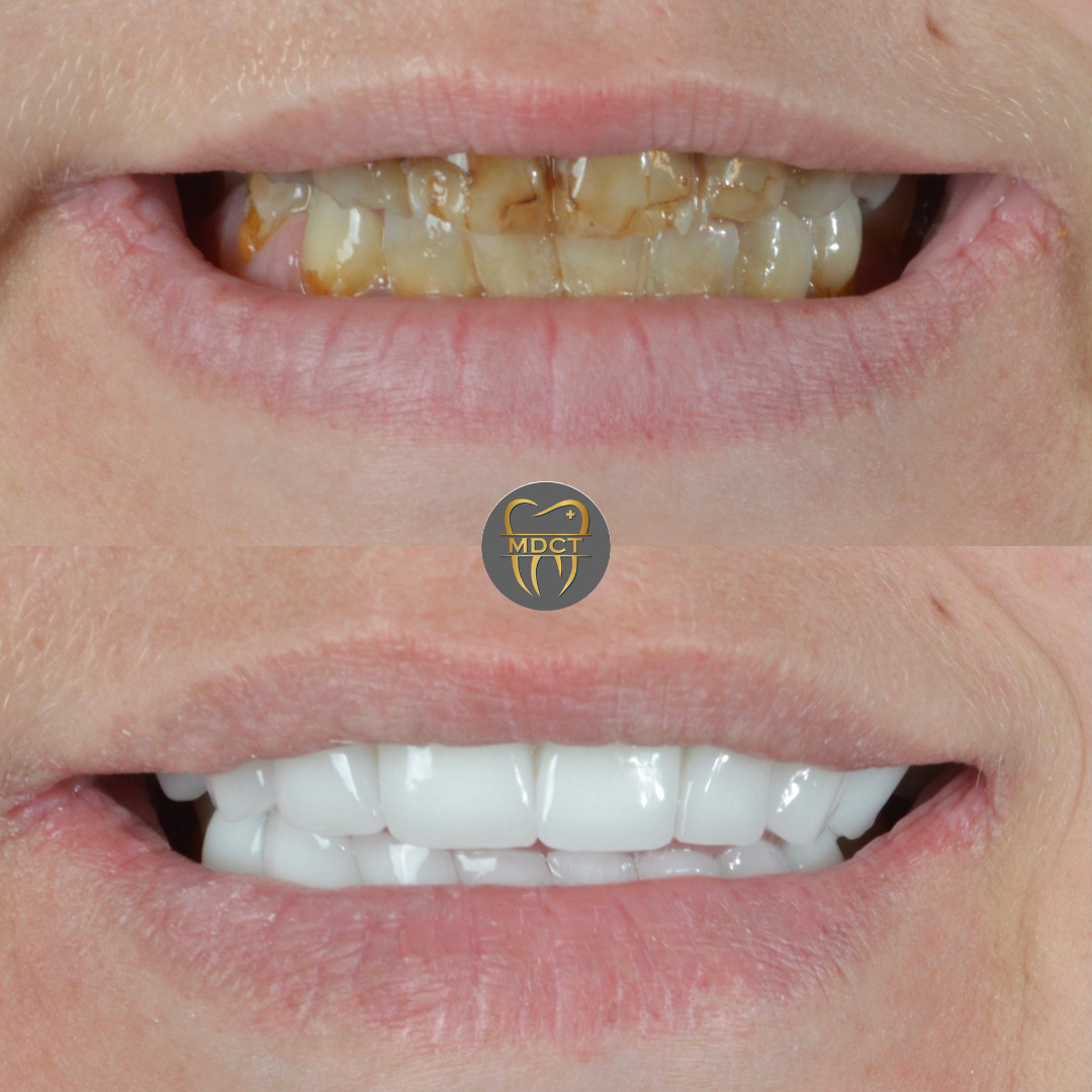 Marmaris Dental Clinic Turkey photo 5