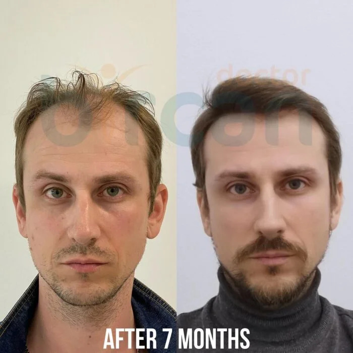 MD. Doctor Bircan photo 1