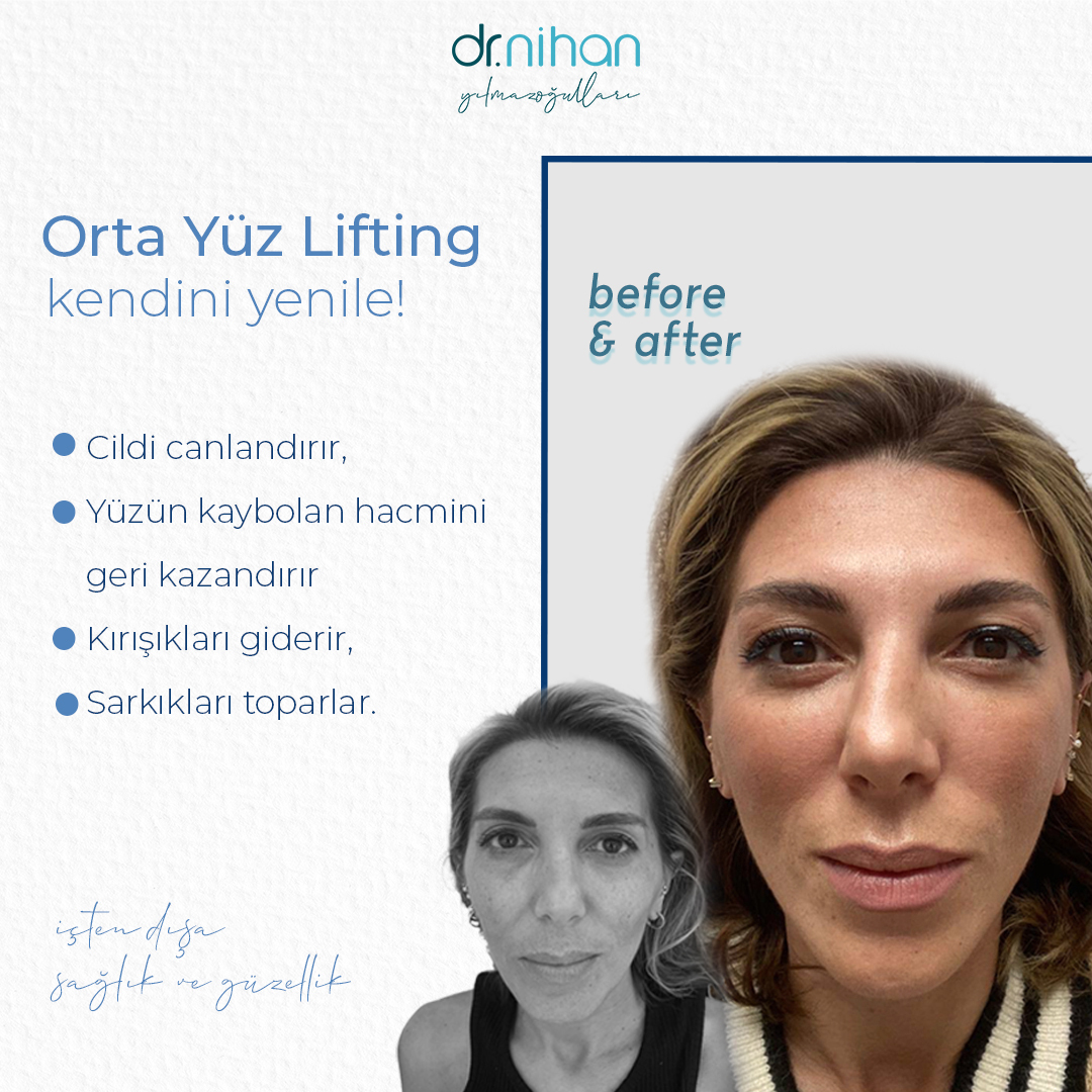 MD. Nihan Yılmazoğulları photo 1