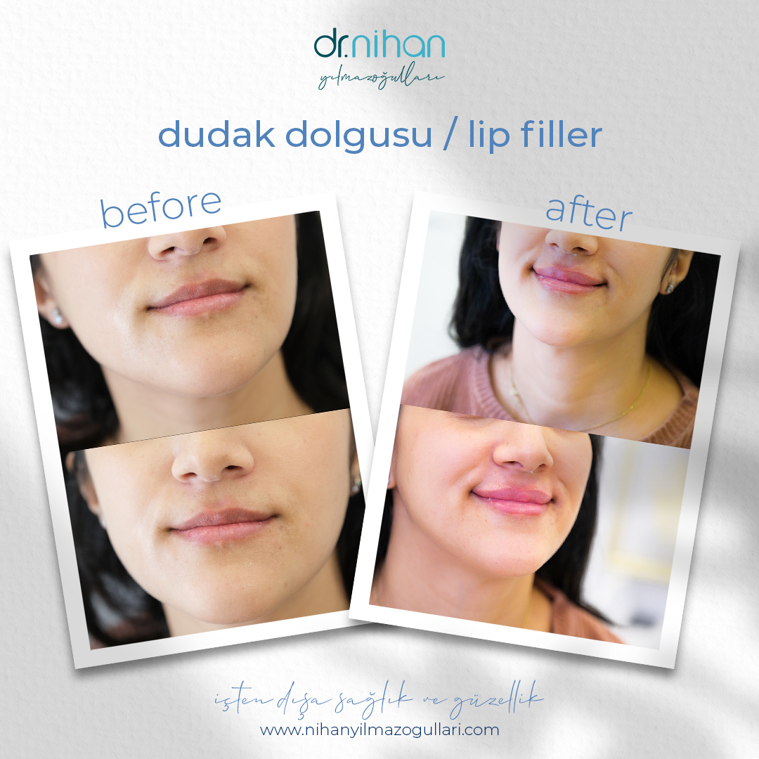 MD. Nihan Yılmazoğulları photo 3