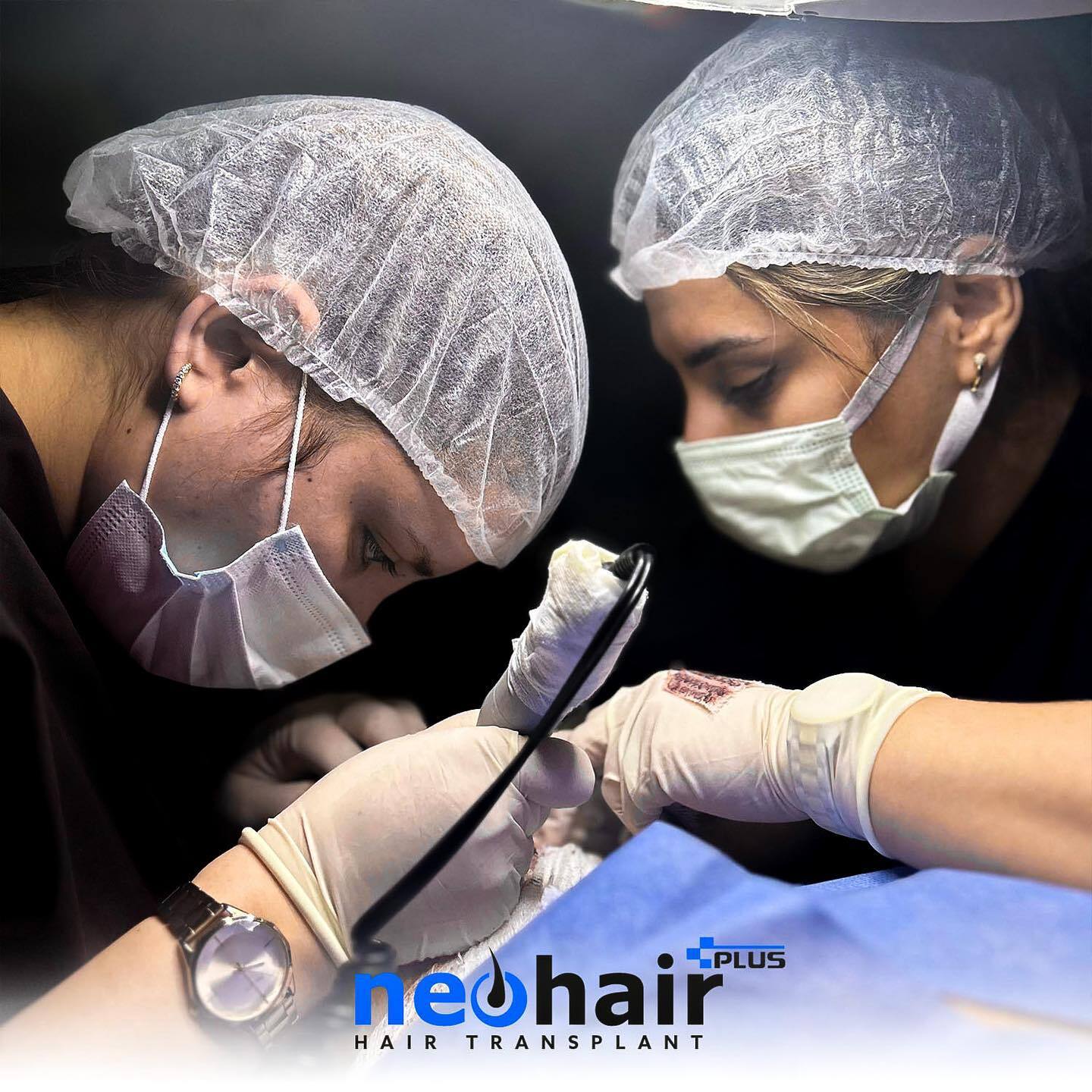 NeoHair Plus Hair Transplant photo 1