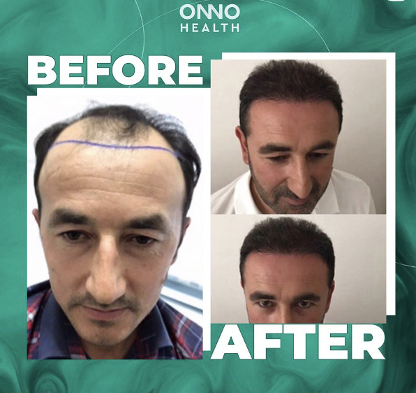 ONNO Health photo 1