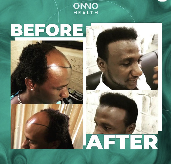ONNO Health photo 2