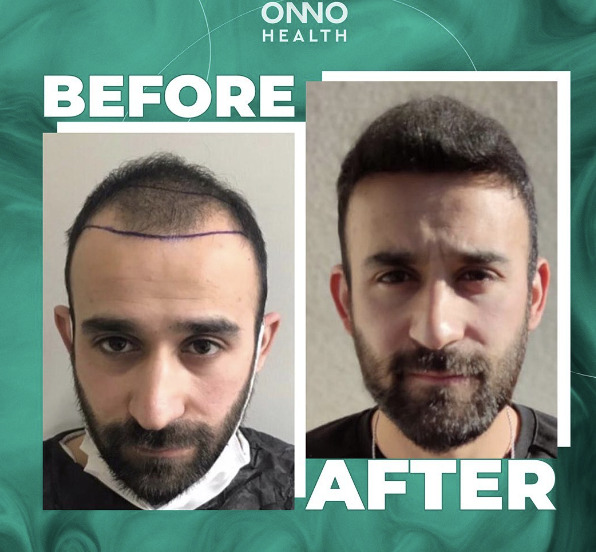 ONNO Health photo 3