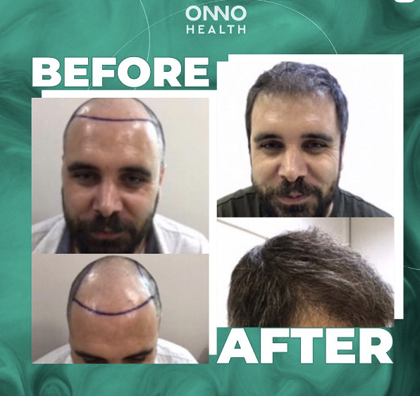 ONNO Health photo 4