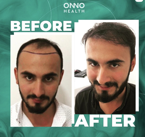 ONNO Health photo 5