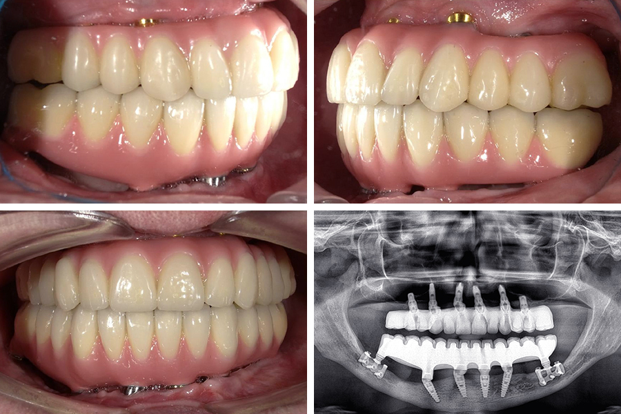 Ortoimplant Dent Spa photo 2
