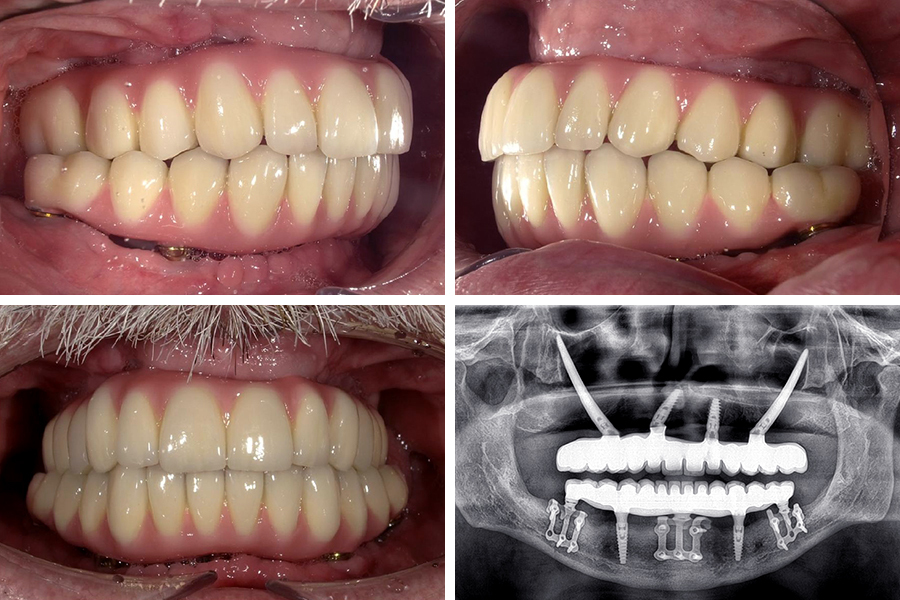 Ortoimplant Dent Spa photo 3
