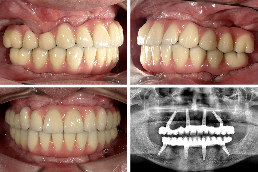 Ortoimplant Dent Spa photo 4