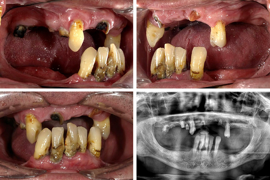 Ortoimplant Dent Spa photo 5