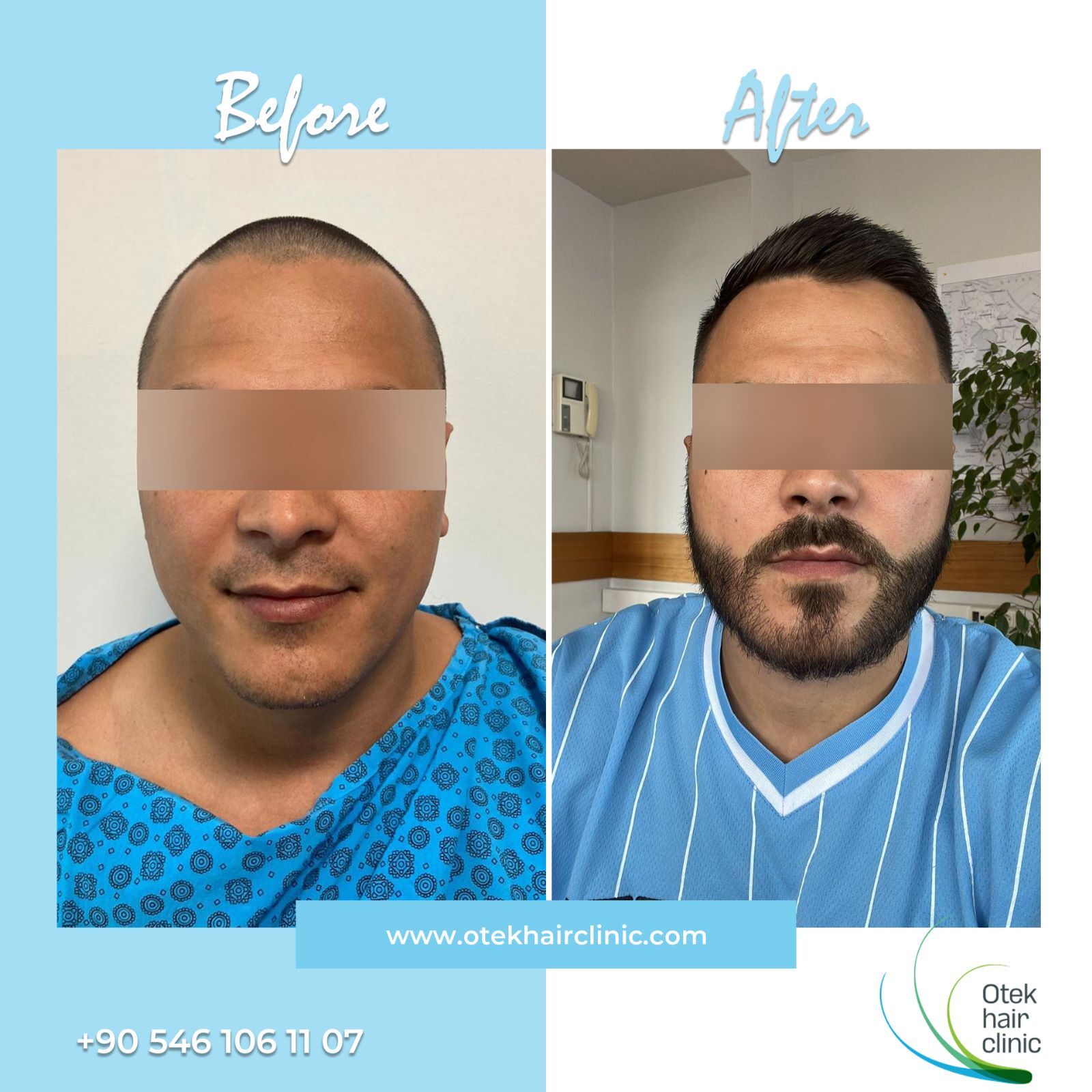 OTEK Hair Clinic photo 1