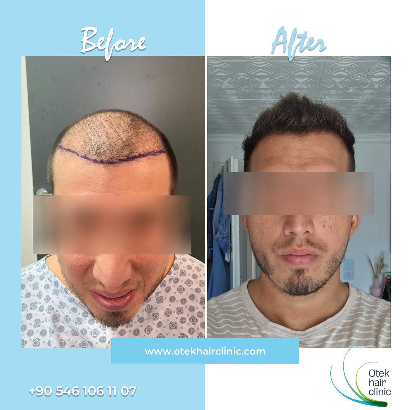 OTEK Hair Clinic photo 2
