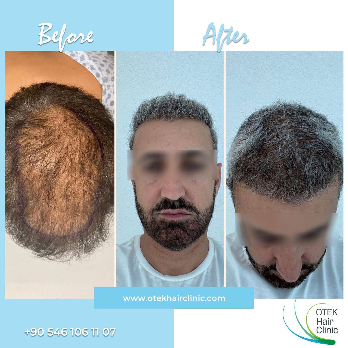 OTEK Hair Clinic photo 3