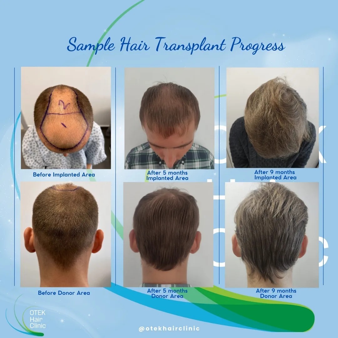 OTEK Hair Clinic photo 5