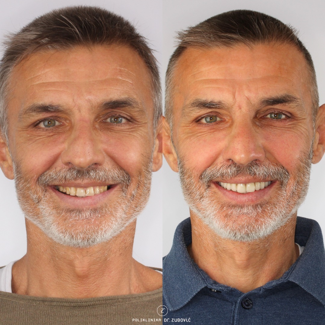 Poliklinika Dr. Zubović - Dr. Zubović Dental Clinic photo 1