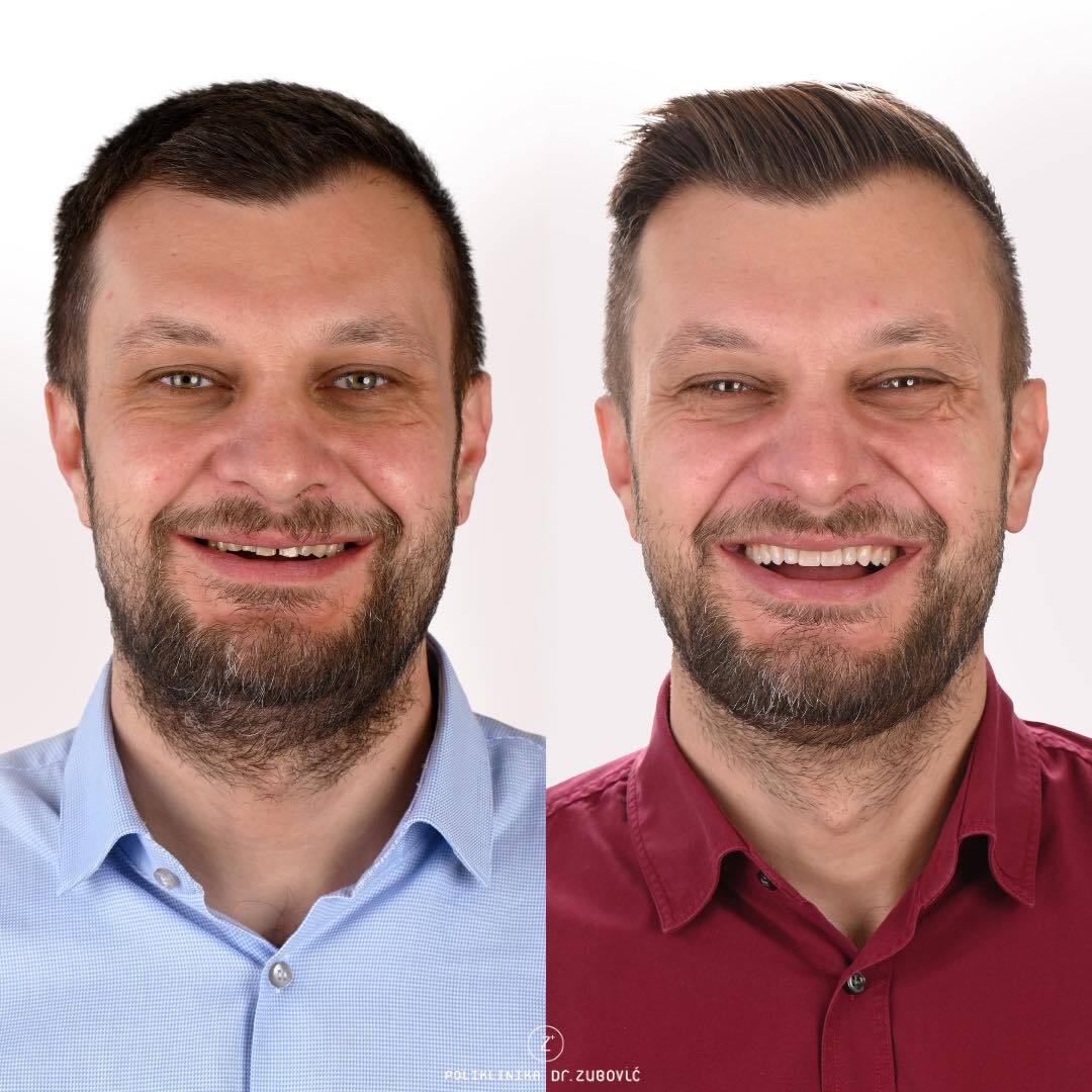 Poliklinika Dr. Zubović - Dr. Zubović Dental Clinic photo 3