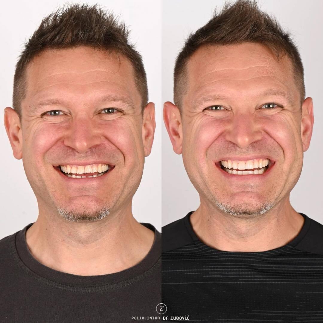 Poliklinika Dr. Zubović - Dr. Zubović Dental Clinic photo 5