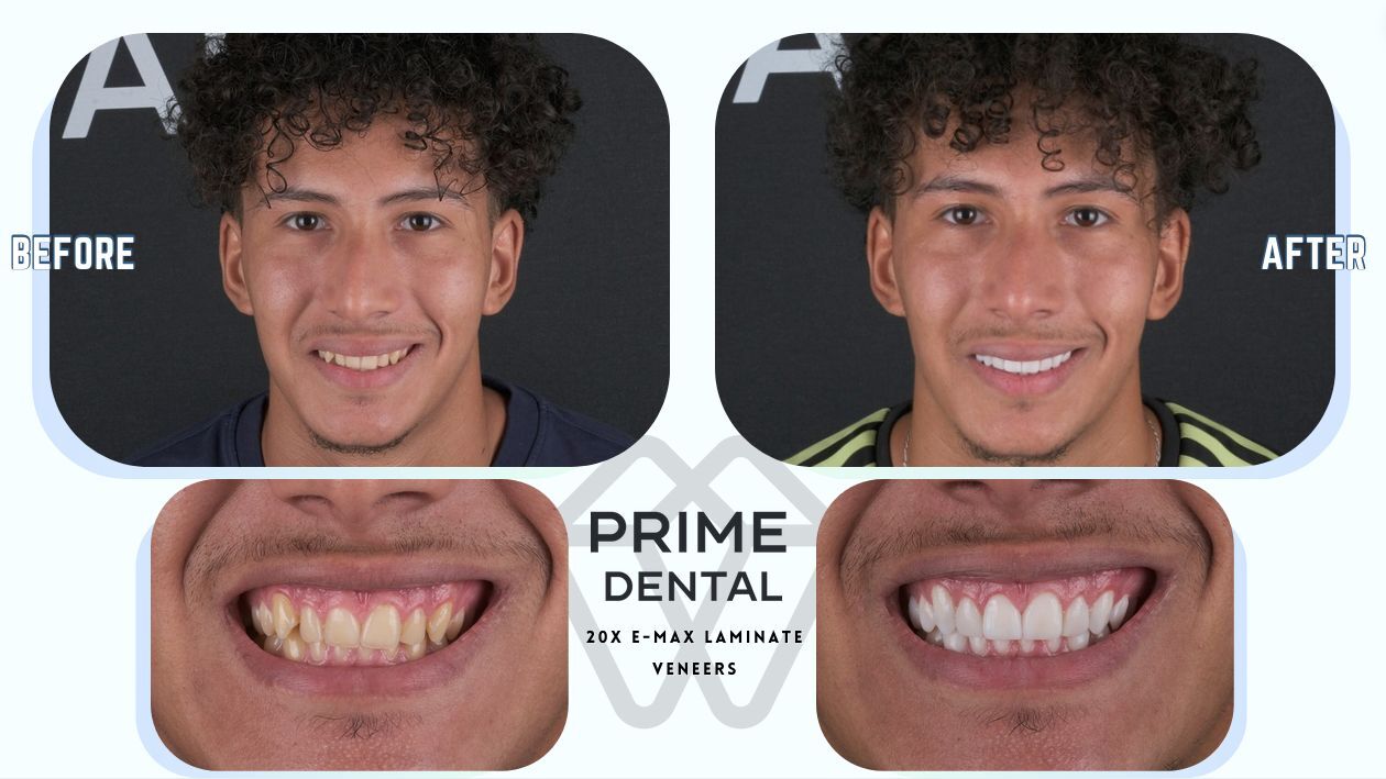 Prime Dental Turkey photo 1