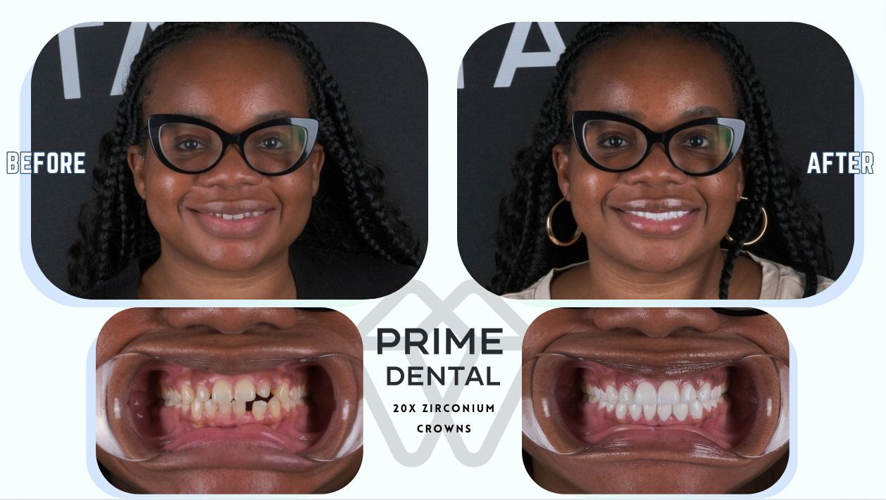 Prime Dental Turkey photo 2