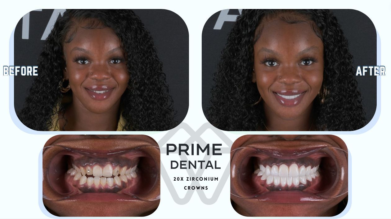 Prime Dental Turkey photo 3