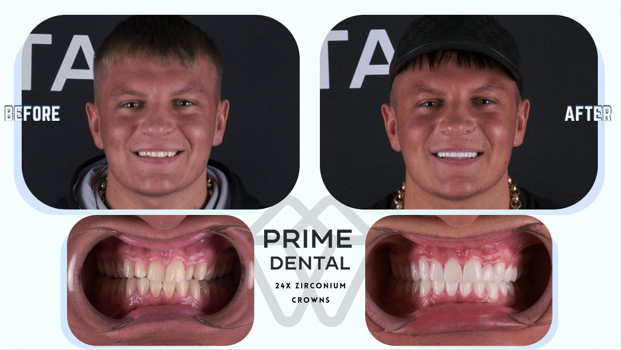 Prime Dental Turkey photo 4