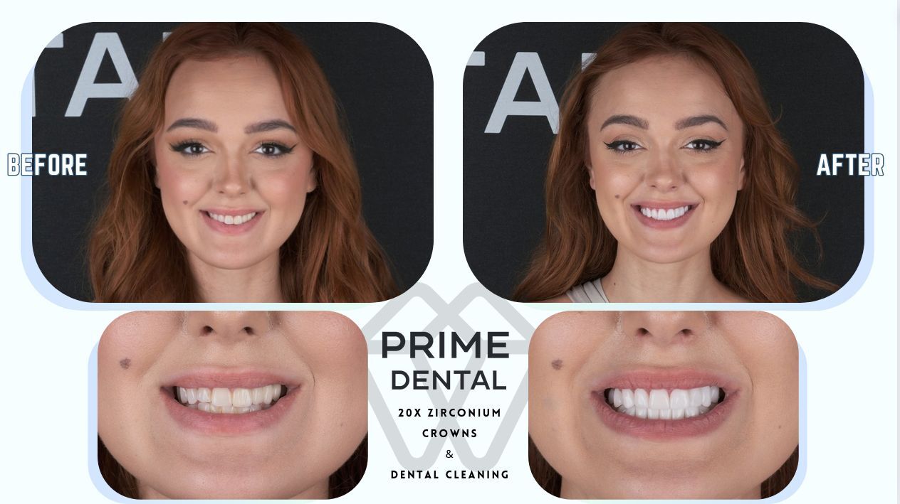 Prime Dental Turkey photo 5