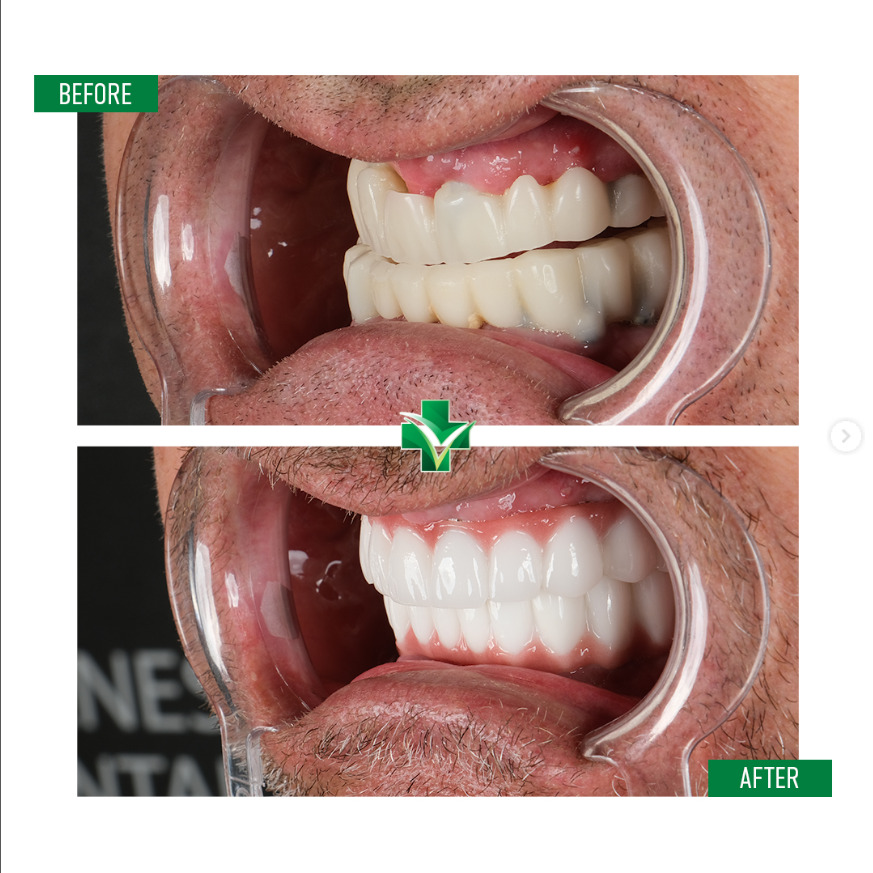 ReGenesis Dental Clinic Turkey photo 1