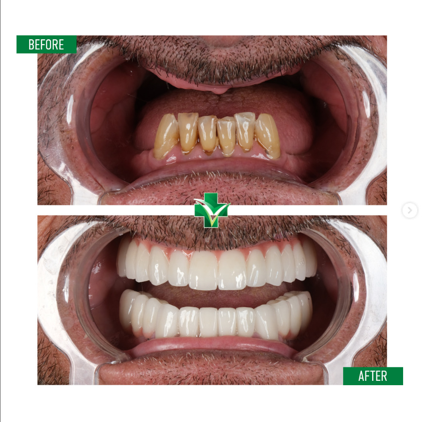 ReGenesis Dental Clinic Turkey photo 2