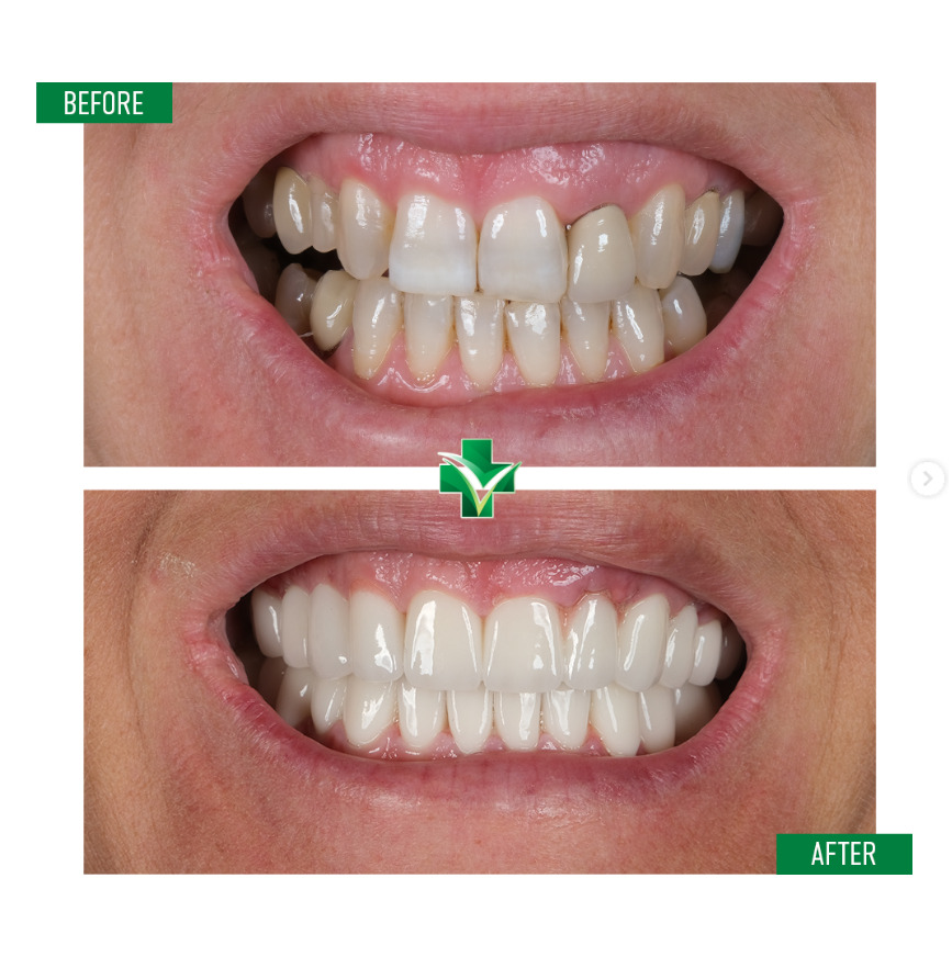 ReGenesis Dental Clinic Turkey photo 3