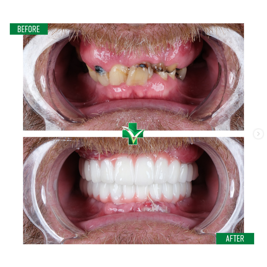 ReGenesis Dental Clinic Turkey photo 4