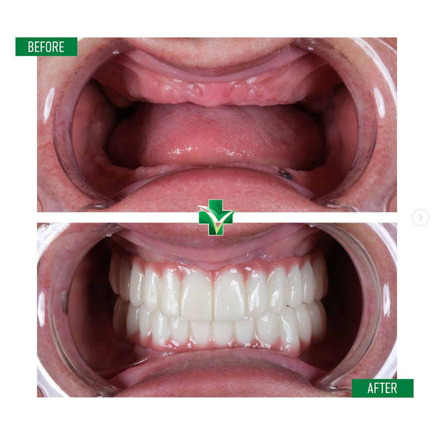ReGenesis Dental Clinic Turkey photo 5