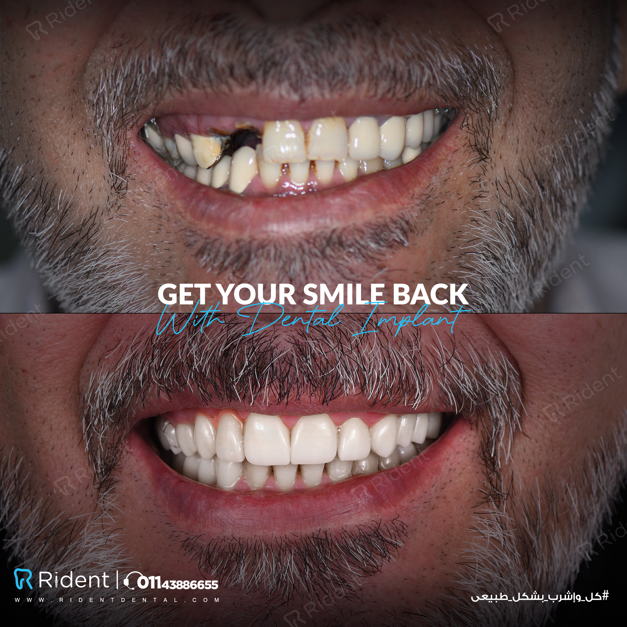 Rident Dental Centers photo 1