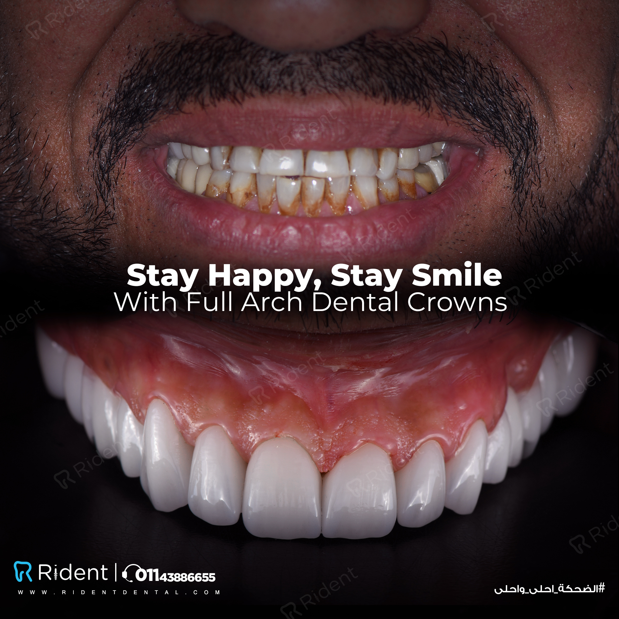 Rident Dental Centers photo 2