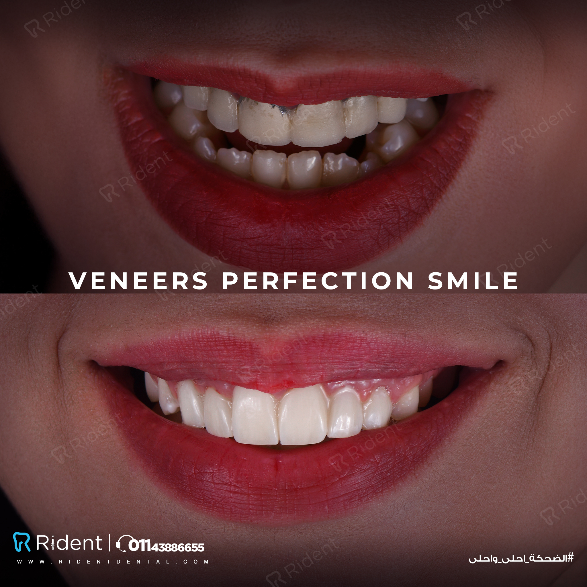 Rident Dental Centers photo 3