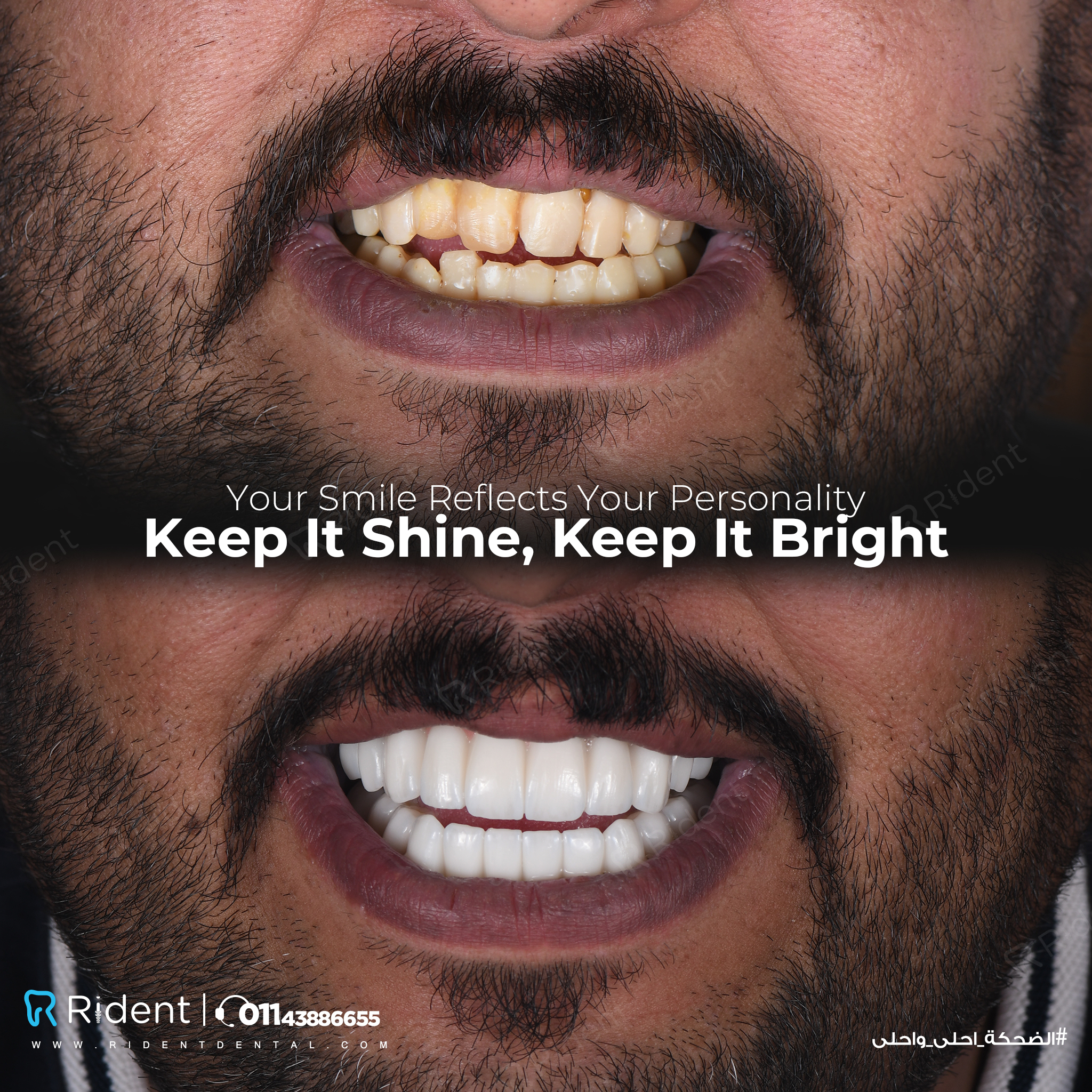 Rident Dental Centers photo 4