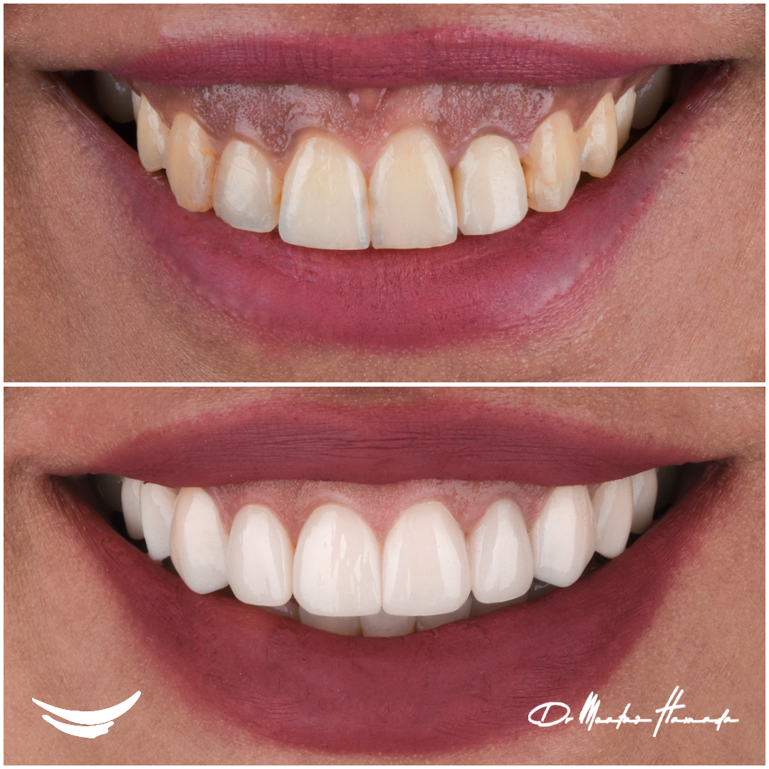 Smile House Dental Center photo 1