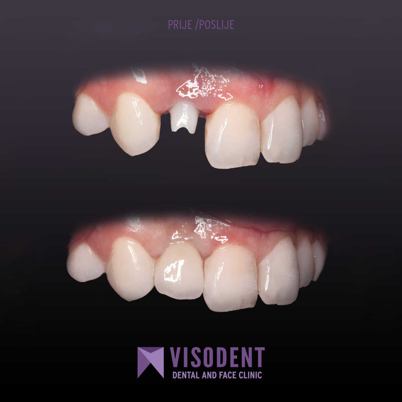 Visodent photo 1