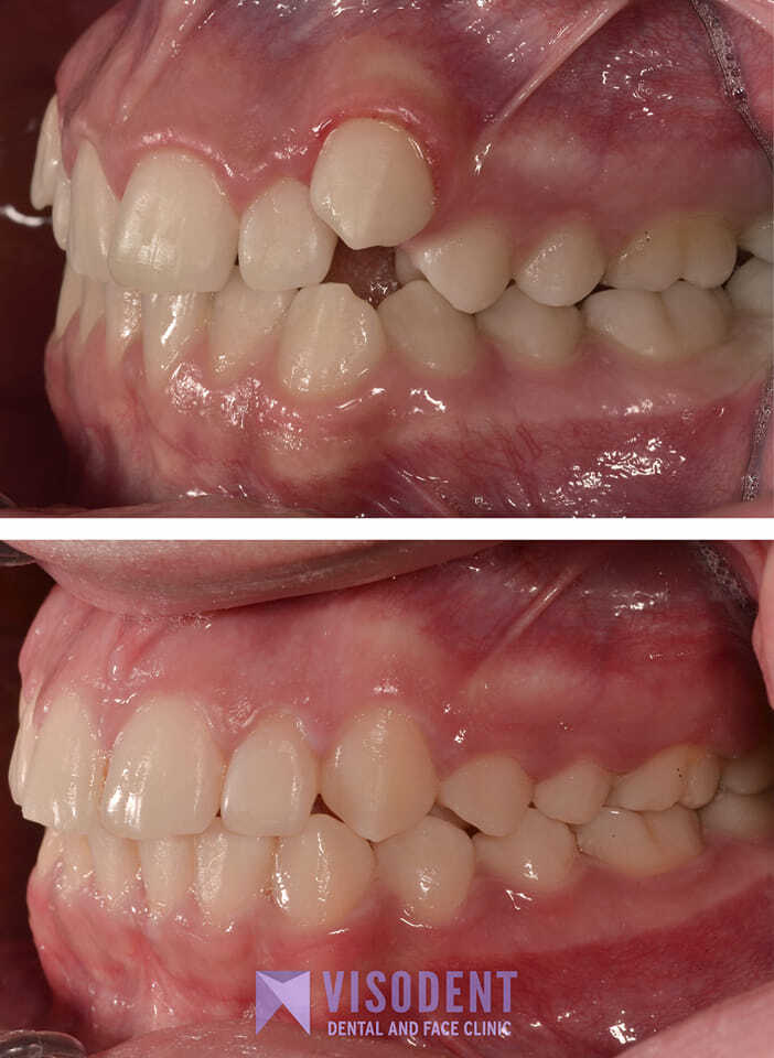 Visodent photo 3