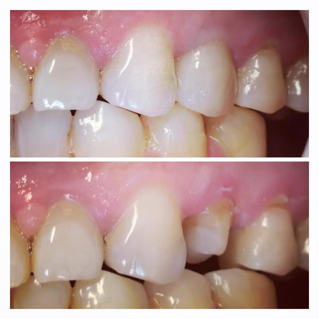 Visodent photo 4