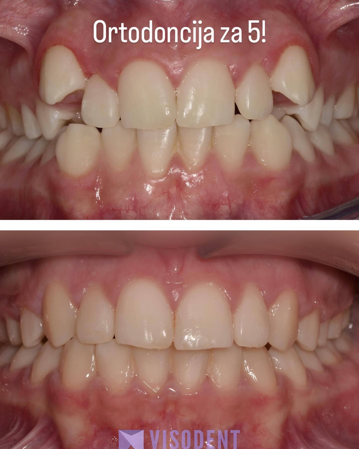 Visodent photo 5
